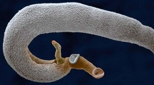 What parasites can live in the human stomach